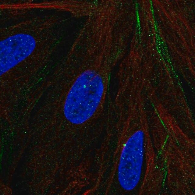 Anti-MTMR9 antibody produced in rabbit