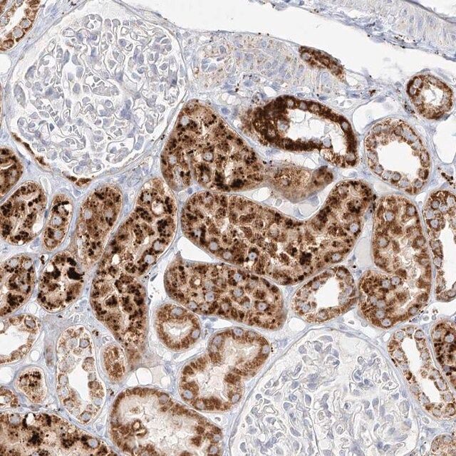 Anti-MTX2 antibody produced in rabbit