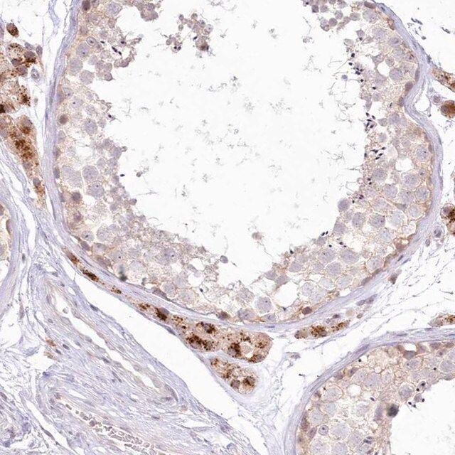 Anti-MTMR3 antibody produced in rabbit