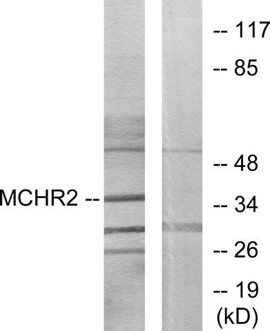 Anti-MCHR2 antibody produced in rabbit