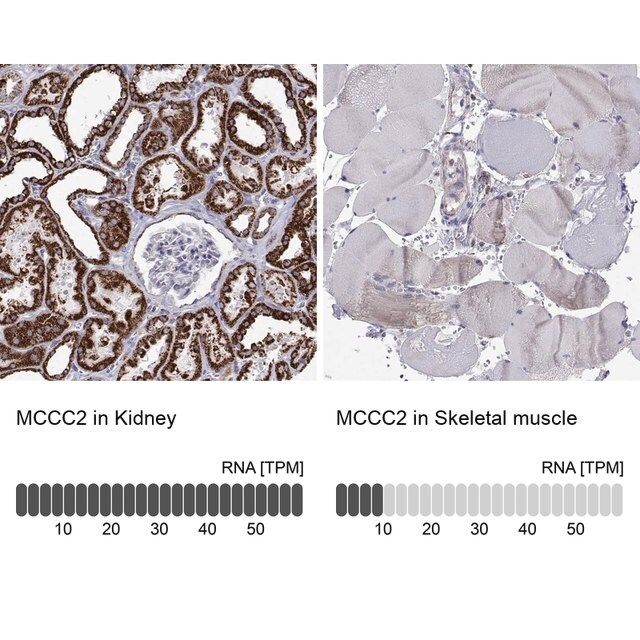 Anti-MCCC2 antibody produced in rabbit