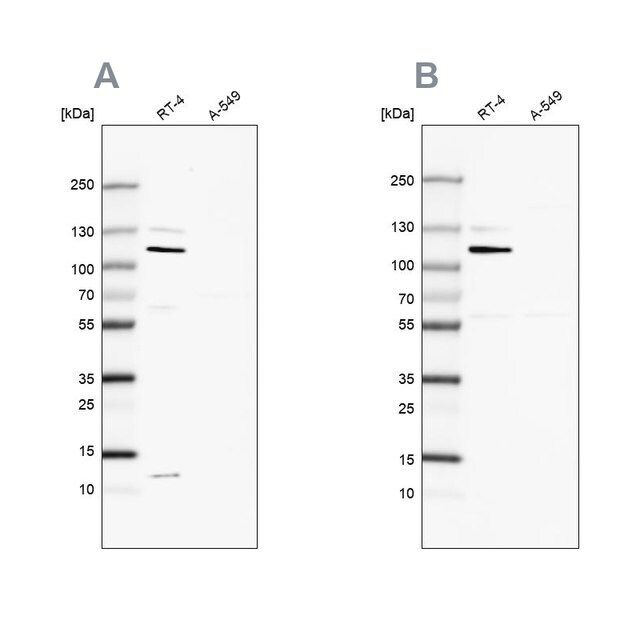 Anti-MCC antibody produced in rabbit