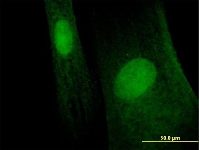 Anti-MAGEB6 antibody produced in mouse