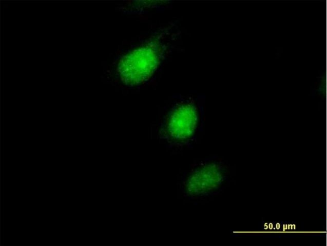 Anti-MAD2L1BP antibody produced in mouse