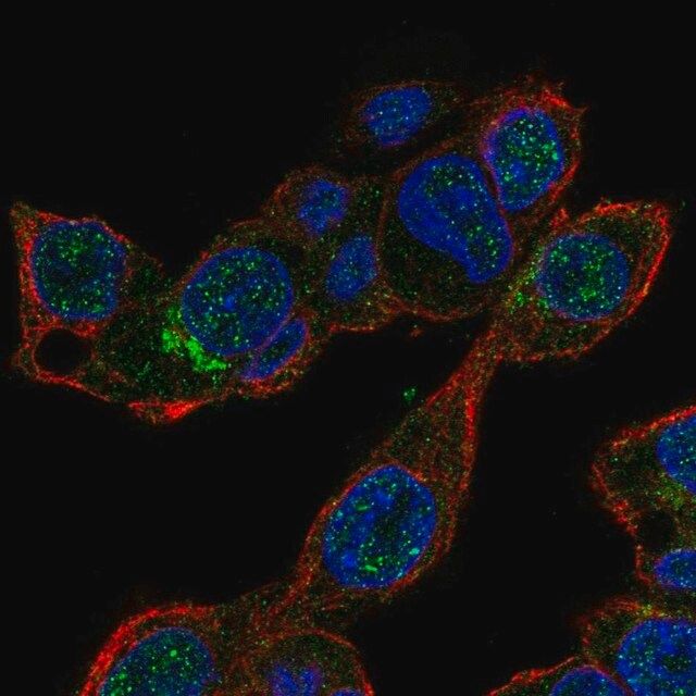 Anti-MALRD1 antibody produced in rabbit