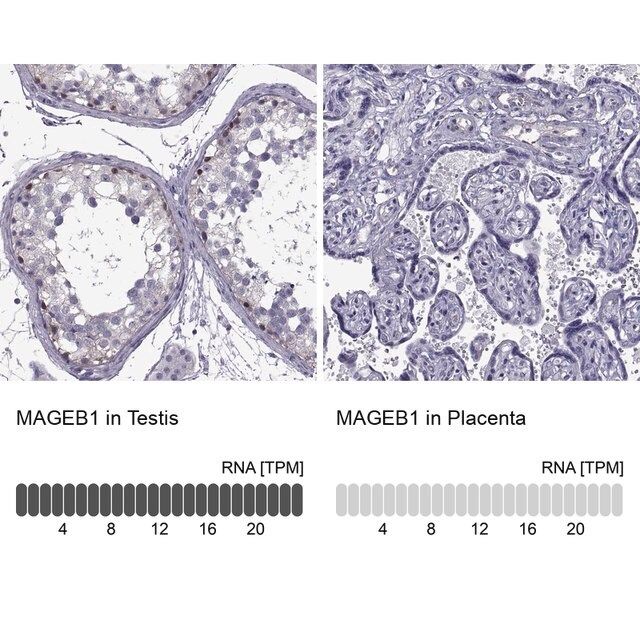 ANTI-MAGEB1 antibody produced in rabbit