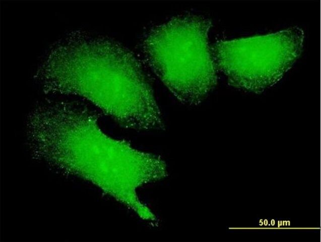 Anti-MAGEB18 antibody produced in mouse