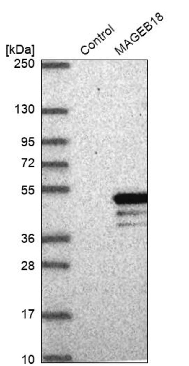 Anti-MAGEB18 antibody produced in rabbit