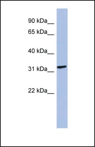 Anti-MAGEB2, (N-terminal) antibody produced in rabbit