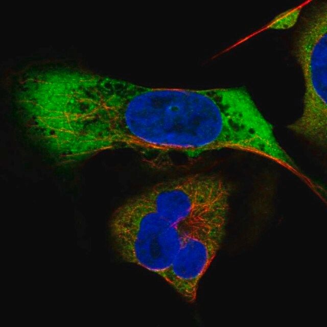 Anti-MAGEB2 antibody produced in rabbit