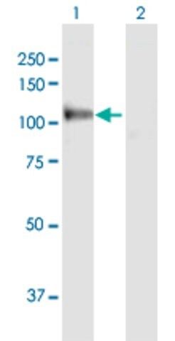 Anti-MANBA antibody produced in rabbit