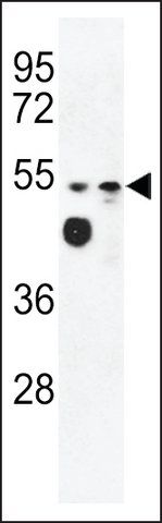 ANTI-MALD2(C-TERMINAL) antibody produced in rabbit