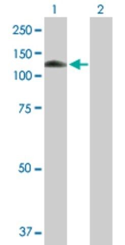 Anti-MANBA antibody produced in mouse