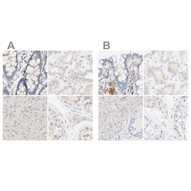 Anti-MANEA antibody produced in rabbit