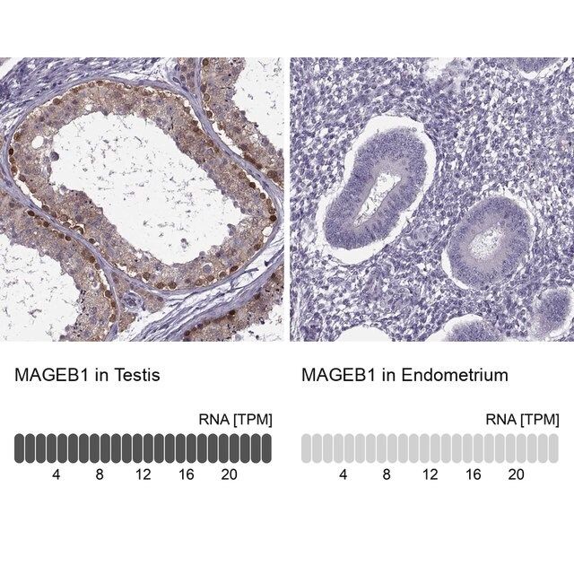 ANTI-MAGEB1 antibody produced in rabbit