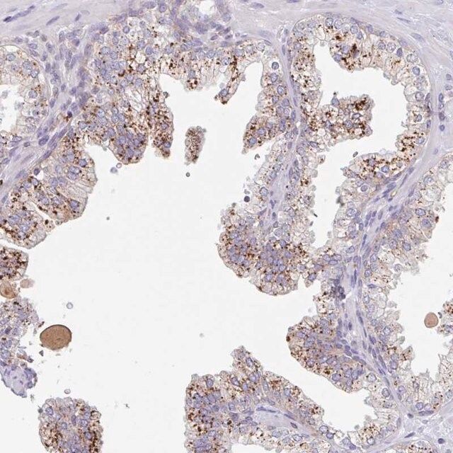 Anti-MANBA antibody produced in rabbit