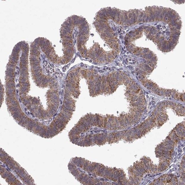 Anti-MANBAL antibody produced in rabbit