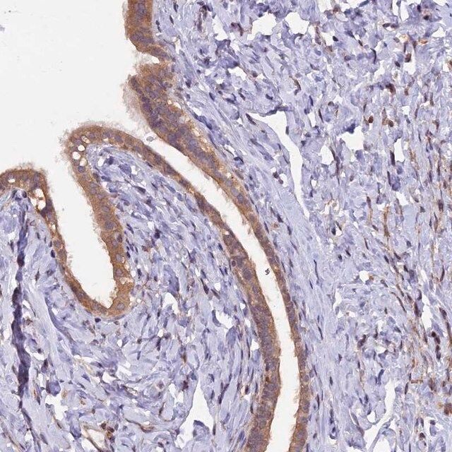 Anti-MAN2C1 antibody produced in rabbit