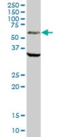 Anti-MAOA antibody produced in mouse