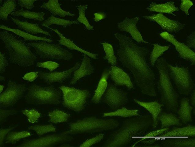 Anti-MALT1 antibody produced in rabbit