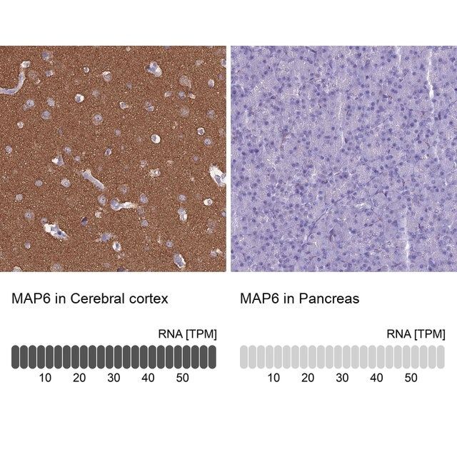 Anti-MAP6 antibody produced in rabbit