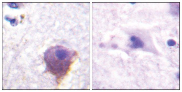 Anti-MAP4 antibody produced in rabbit