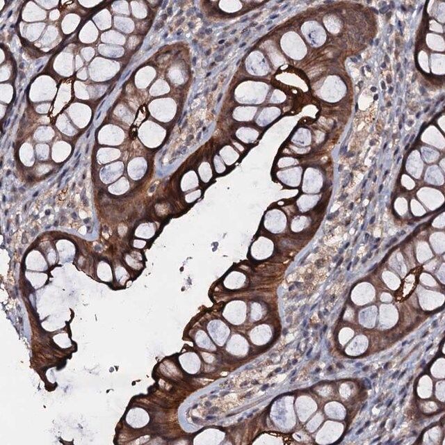 Anti-MANSC4 antibody produced in rabbit