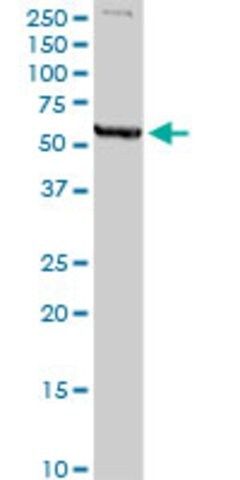 Anti-MAOA antibody produced in rabbit