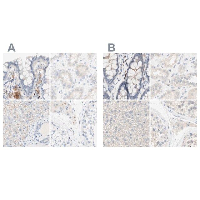 Anti-MANEA antibody produced in rabbit