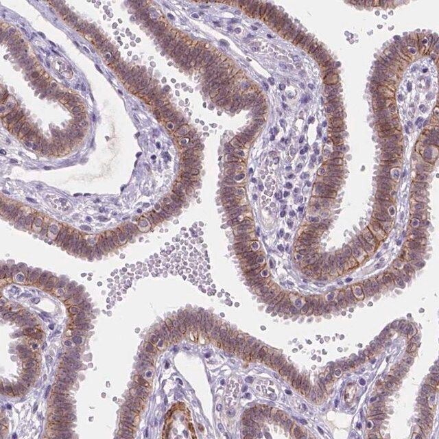 Anti-MAN2C1 antibody produced in rabbit