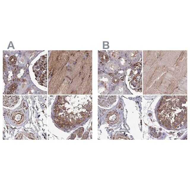 Anti-MAP4 antibody produced in rabbit