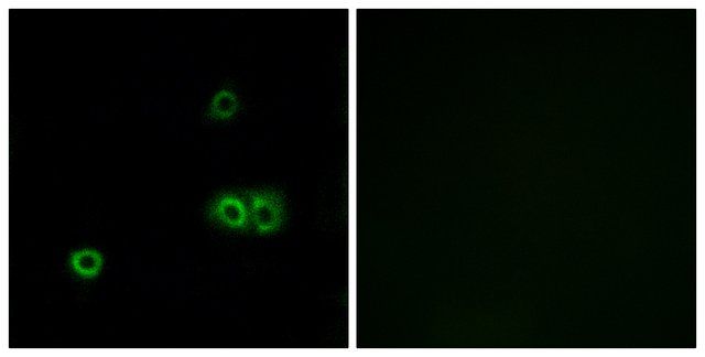 Anti-MARCH5 antibody produced in rabbit