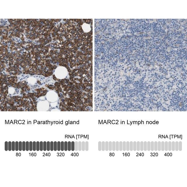 Anti-MARC2 antibody produced in rabbit