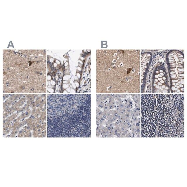 Anti-MARCH7 antibody produced in rabbit