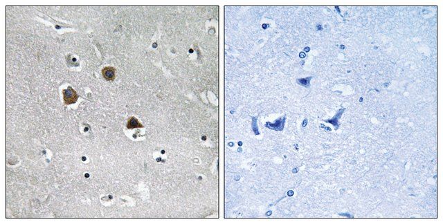 Anti-MARK1 antibody produced in rabbit