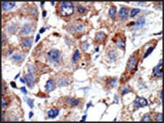 Anti-MBD3 (C-term C215) antibody produced in rabbit