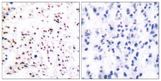 Anti-MCM5 antibody produced in rabbit