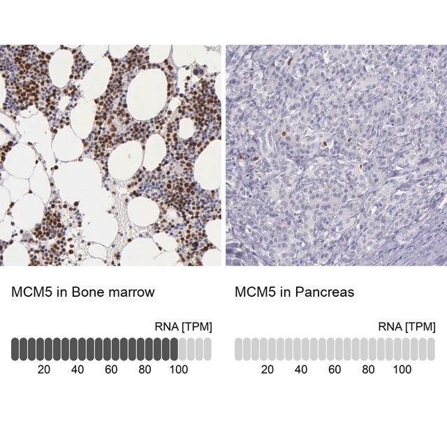 Anti-MCM5 antibody produced in rabbit