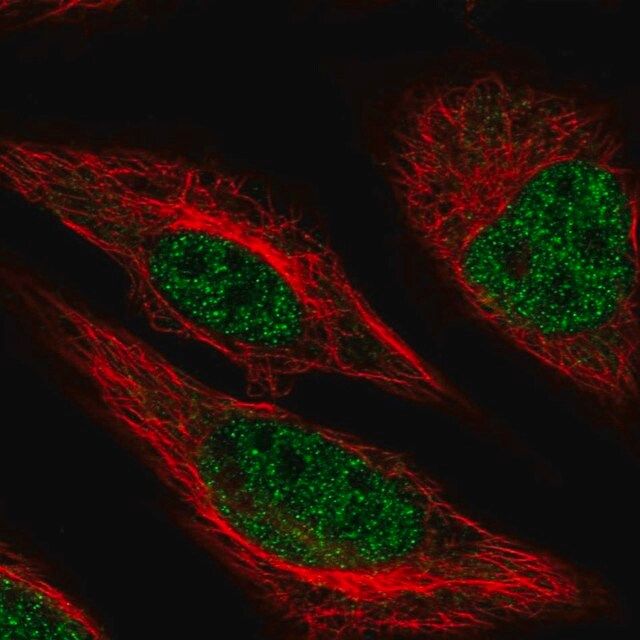 Anti-MACROD1 antibody produced in rabbit