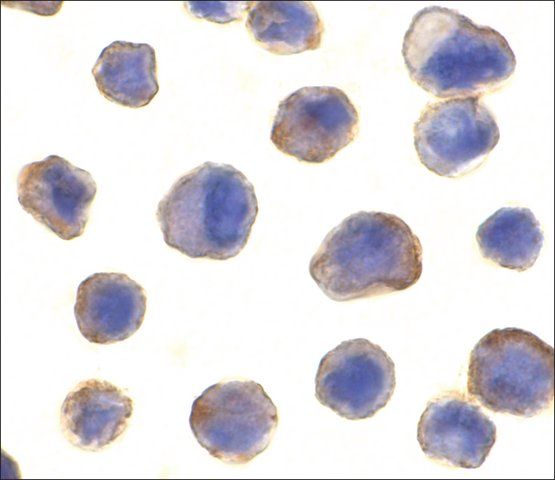 Anti-MADD antibody produced in rabbit