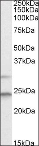 Anti-MAD2L1 (C-terminal) antibody produced in goat