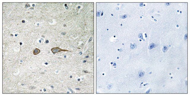 Anti-MADD antibody produced in rabbit