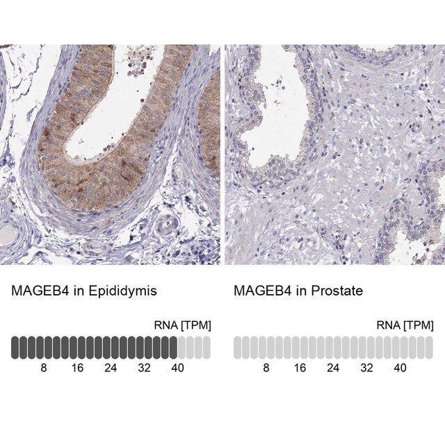 Anti-MAGEB4 antibody produced in rabbit