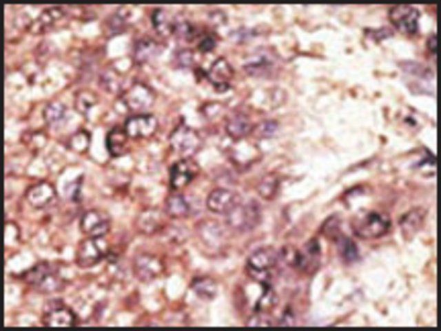 Anti-MAGEB3 (N-term) antibody produced in rabbit