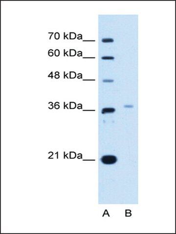 Anti-LHX8 antibody produced in rabbit