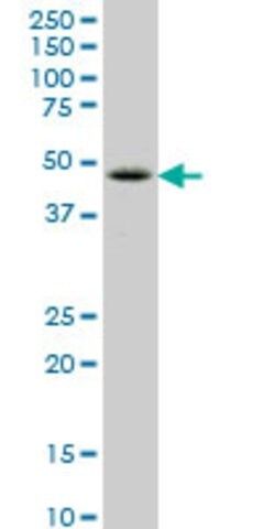 ANTI-LHX6 antibody produced in mouse