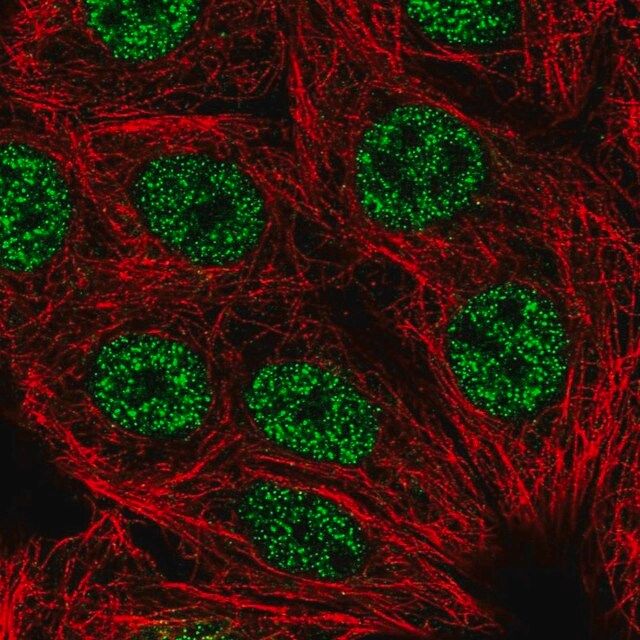 Anti-LHX2 antibody produced in rabbit