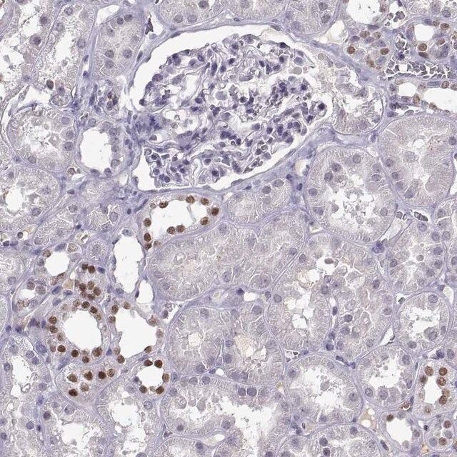 Anti-LHX1 antibody produced in rabbit