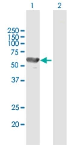 Anti-KRT12 antibody produced in mouse