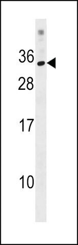 ANTI-KRBOX1(C-TERMINAL) antibody produced in rabbit